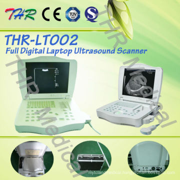 Full Digital Laptop Ultrasound Scanner